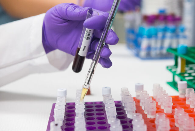 A biomedical researcher injecting a sample into a vial as part of an experiment