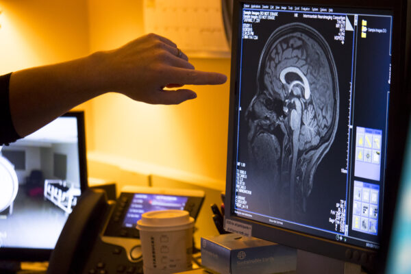 A person pointing to a magnetic resonance imaging (MRI) of the brain displayed on a computer screen